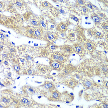 Immunohistochemistry - QARS Polyclonal Antibody 