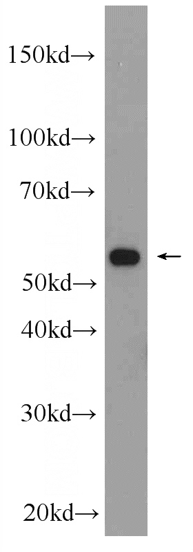 mouse liver tissue were subjected to SDS PAGE followed by western blot with Catalog No:112534(MFSD8 Antibody) at dilution of 1:1000