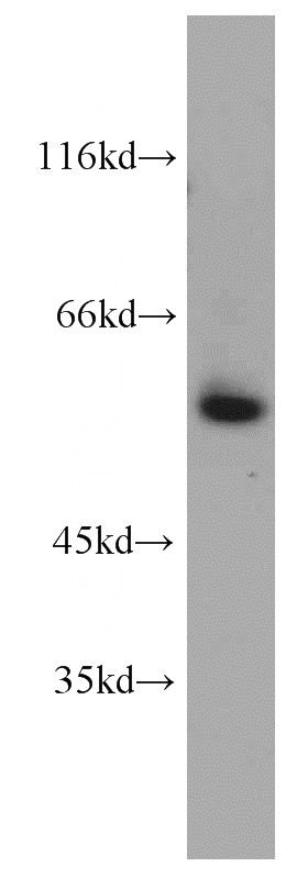 HEK-293 cells were subjected to SDS PAGE followed by western blot with Catalog No:116739(VEGFR1, FLT1 antibody) at dilution of 1:800