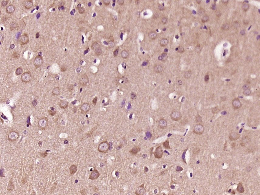 Fig2: Paraformaldehyde-fixed, paraffin embedded (Rat brain); Antigen retrieval by boiling in sodium citrate buffer (pH6.0) for 15min; Block endogenous peroxidase by 3% hydrogen peroxide for 20 minutes; Blocking buffer (normal goat serum) at 37℃ for 30min; Antibody incubation with (LIPA2) Polyclonal Antibody, Unconjugated at 1:500 overnight at 4℃, followed by a conjugated secondary (sp-0023) for 20 minutes and DAB staining.
