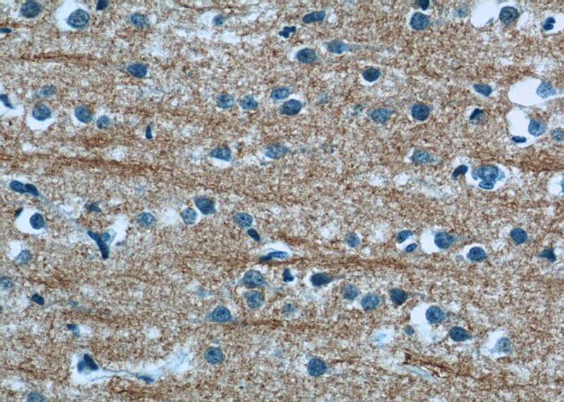 Immunohistochemistry of paraffin-embedded human brain tissue slide using Catalog No:113256(NMU Antibody) at dilution of 1:50 (under 40x lens)