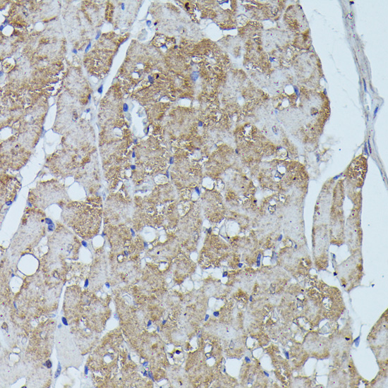 Immunohistochemistry - FLII Polyclonal Antibody 