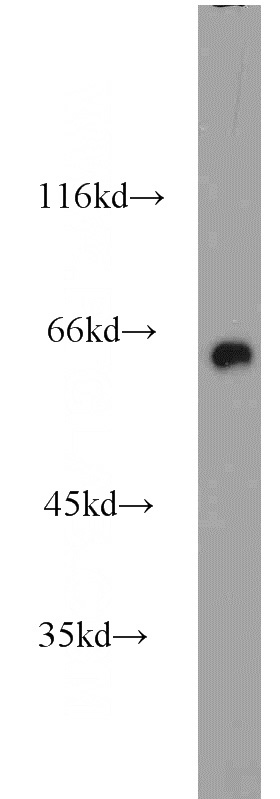 mouse brain tissue were subjected to SDS PAGE followed by western blot with Catalog No:109569(CRMP1 antibody) at dilution of 1:1000