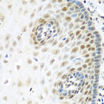 Immunohistochemistry - MDC1 Polyclonal Antibody 