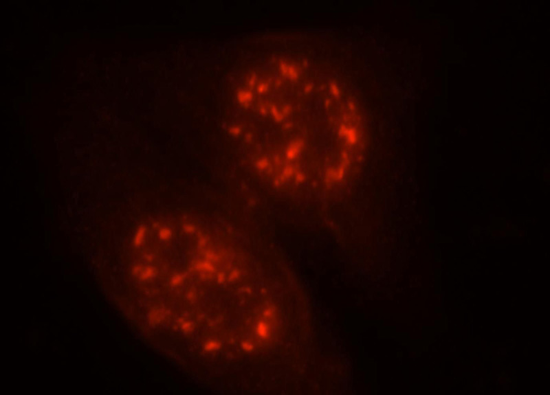 Immunofluorescent analysis of HepG2 cells, using CASC3 antibody Catalog No:112684 at 1:25 dilution and Rhodamine-labeled goat anti-rabbit IgG (red).