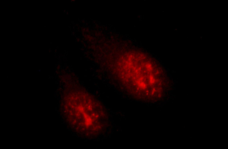 Immunofluorescent analysis of HepG2 cells, using PSMC3IP antibody Catalog No:111523 at 1:25 dilution and Rhodamine-labeled goat anti-rabbit IgG (red).