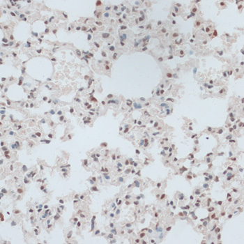 Immunohistochemistry - ZNF416 Polyclonal Antibody 