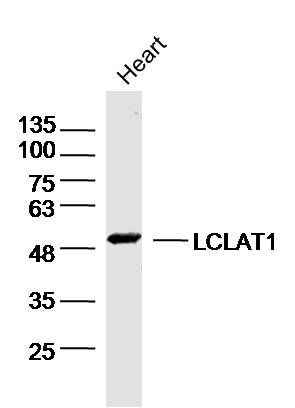 Fig1: Sample:Heart (Mouse)Lysate at 40 ug; Primary: Anti-LCLAT1 at 1/300 dilution; Secondary: IRDye800CW Goat Anti-RabbitIgG at 1/20000 dilution; Predicted band size: 49kD; Observed band size: 49kD