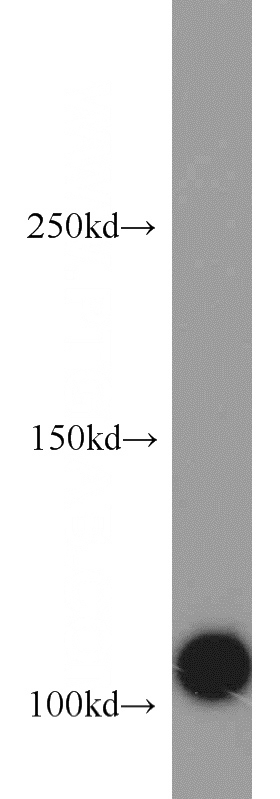 HeLa cells were subjected to SDS PAGE followed by western blot with Catalog No:109593(CSE1L antibody) at dilution of 1:1000