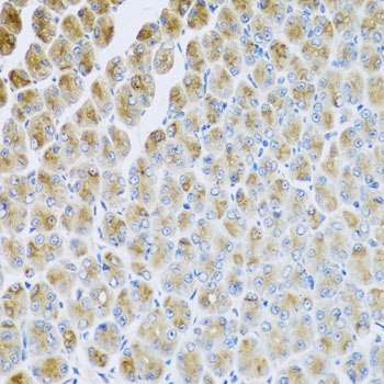 Immunohistochemistry - AP1M2 Polyclonal Antibody 
