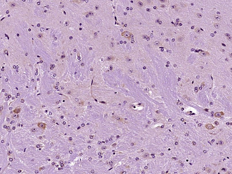 Fig1: Paraformaldehyde-fixed, paraffin embedded (Mouse brain); Antigen retrieval by boiling in sodium citrate buffer (pH6.0) for 15min; Block endogenous peroxidase by 3% hydrogen peroxide for 20 minutes; Blocking buffer (normal goat serum) at 37℃ for 30min; Antibody incubation with (SCFD2) Polyclonal Antibody, Unconjugated at 1:400 overnight at 4℃, followed by operating according to SP Kit(Rabbit) (sp-0023) instructionsand DAB staining.