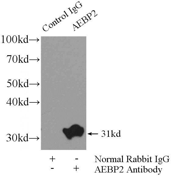 IP Result of anti-AEBP2 (IP:Catalog No:107898, 4ug; Detection:Catalog No:107898 1:300) with mouse testis tissue lysate 4800ug.