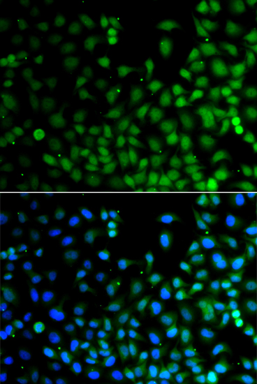 Immunofluorescence - LHX6 Polyclonal Antibody 