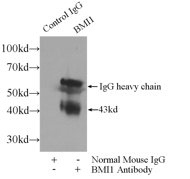 IP Result of anti-BMI1 (IP:Catalog No:107019, 3ug; Detection:Catalog No:107019 1:1000) with HEK-293 cells lysate 1800ug.
