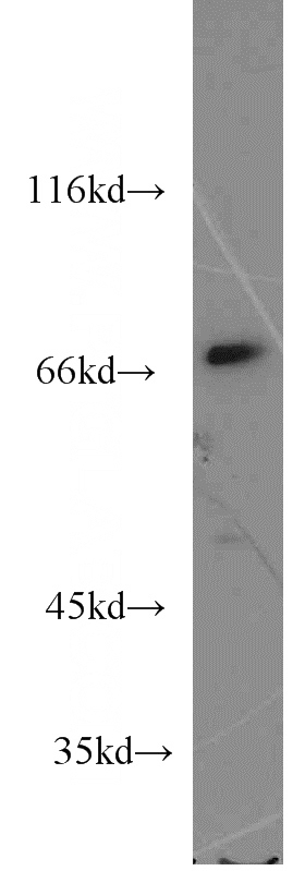 HeLa cells were subjected to SDS PAGE followed by western blot with Catalog No:113415(OPTN antibody) at dilution of 1:800