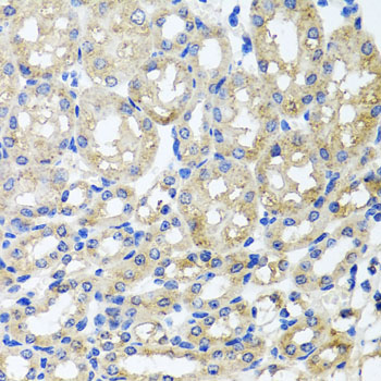 Immunohistochemistry - ST8SIA2 Polyclonal Antibody 