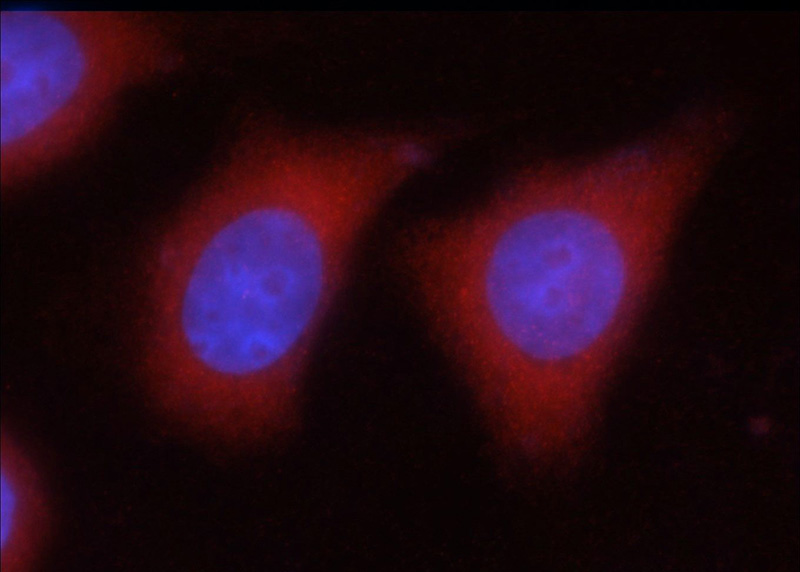 Immunofluorescent analysis of HeLa cells using Catalog No:110818(GAD2 Antibody) at dilution of 1:25 and Rhodamine-Goat anti-Rabbit IgG