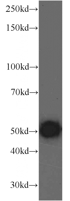 mouse testis tissue were subjected to SDS PAGE followed by western blot with Catalog No:112085(KLHDC3 antibody) at dilution of 1:1500