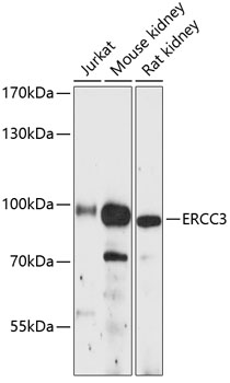 Western blot - ERCC3 Polyclonal Antibody 