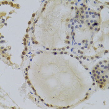 Immunohistochemistry - HDGF Polyclonal Antibody 