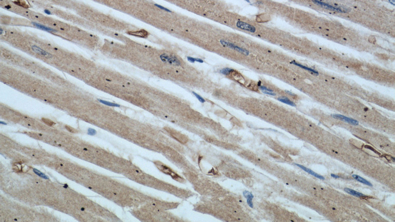 Immunohistochemical of paraffin-embedded human heart using Catalog No:113001(MYPT1 antibody) at dilution of 1:50 (under 40x lens)