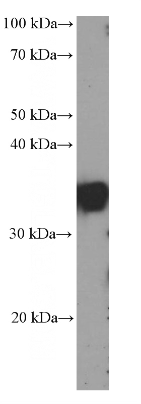 HepG2 cells were subjected to SDS PAGE followed by western blot with Catalog No:107586(SGTA Antibody) at dilution of 1:4000