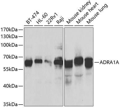 Western blot - ADRA1A Polyclonal Antibody 