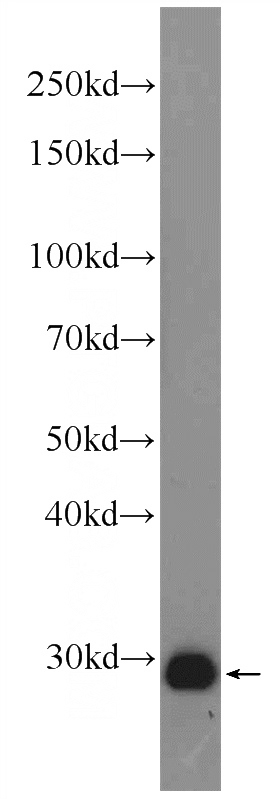 fetal human brain tissue were subjected to SDS PAGE followed by western blot with Catalog No:108909(Calretinin Antibody) at dilution of 1:2000
