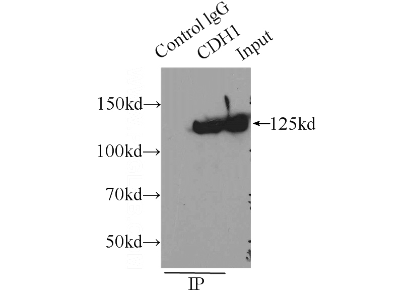 IP Result of anti-E-cadherin (IP:Catalog No:110288, 3ug; Detection:Catalog No:110288 1:1000) with A431 cells lysate 3000ug.
