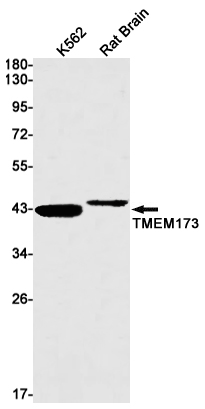 Western blot detection of TMEM173 in K562,Rat Brain lysates using TMEM173 Rabbit mAb(1:1000 diluted).Predicted band size:42kDa.Observed band size:40kDa.