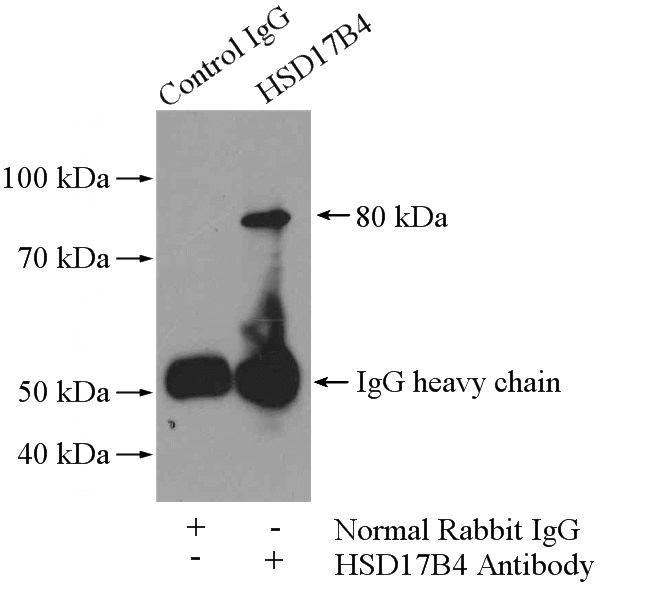 IP Result of anti-HSD17B4 (IP:Catalog No:111547, 4ug; Detection:Catalog No:111547 1:500) with mouse brain tissue lysate 4000ug.