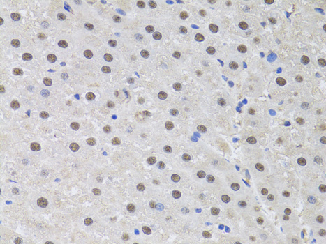 Immunohistochemistry - HUS1 Polyclonal Antibody 