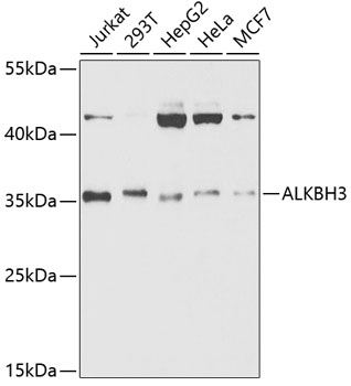 Western blot - ALKBH3 Polyclonal Antibody 