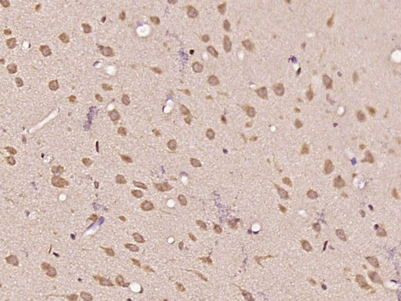 Fig3: Paraformaldehyde-fixed, paraffin embedded (Rat brain); Antigen retrieval by boiling in sodium citrate buffer (pH6.0) for 15min; Block endogenous peroxidase by 3% hydrogen peroxide for 20 minutes; Blocking buffer (normal goat serum) at 37℃ for 30min; Antibody incubation with (GALNT11) Polyclonal Antibody, Unconjugated at 1:400 overnight at 4℃, followed by operating according to SP Kit(Rabbit) (sp-0023) instructionsand DAB staining.