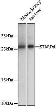 Western blot - STARD4 Polyclonal Antibody 