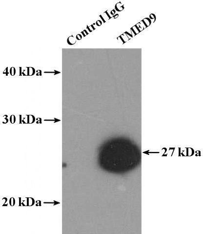 IP Result of anti-TMED9 (IP:Catalog No:116088, 4ug; Detection:Catalog No:116088 1:500) with mouse liver tissue lysate 4000ug.