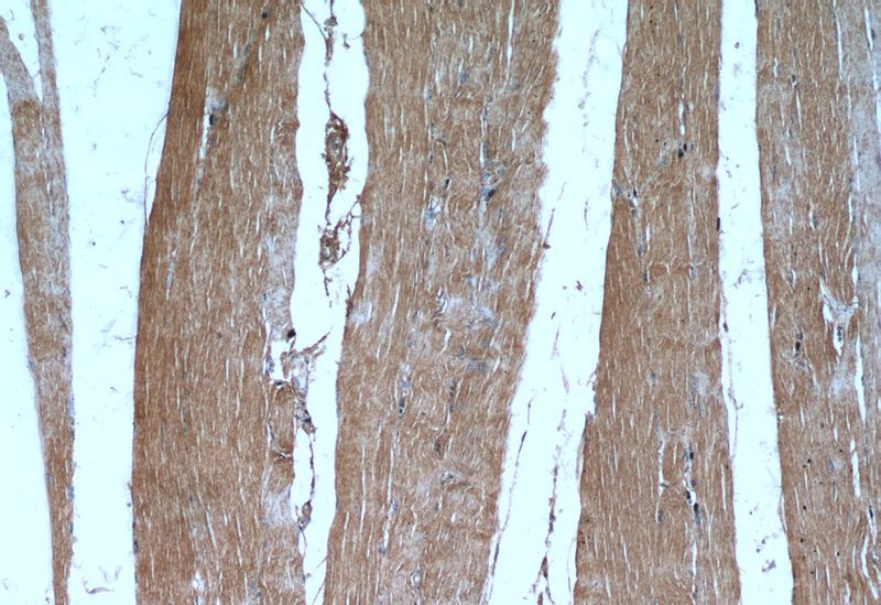 Immunohistochemical of paraffin-embedded human skeletal muscle using Catalog No:110465(FAM120A antibody) at dilution of 1:50 (under 10x lens)
