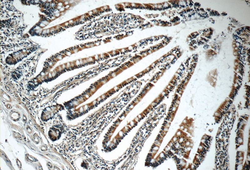 Immunohistochemistry of paraffin-embedded human small intestine tissue slide using Catalog No:112806(ABCC2 Antibody) at dilution of 1:50 (under 10x lens)