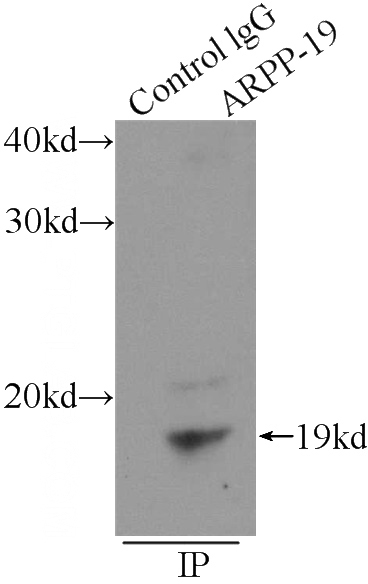 IP Result of anti-ARPP-19 (IP:Catalog No:108170, 3ug; Detection:Catalog No:108170 1:500) with mouse brain tissue lysate 5200ug.