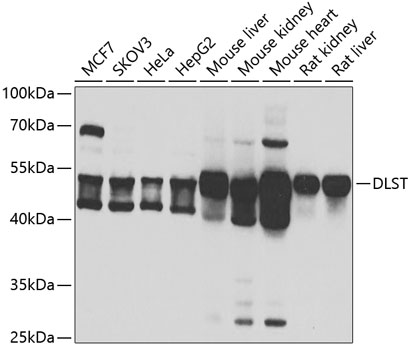 Western blot - DLST Polyclonal Antibody 