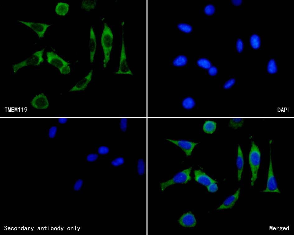 Fig2:; ICC staining of TMEM119 in SH-SY5Y cells (green). Formalin fixed cells were permeabilized with 0.1% Triton X-100 in TBS for 10 minutes at room temperature and blocked with 10% negative goat serum for 15 minutes at room temperature. Cells were probed with the primary antibody ( 1/50) for 1 hour at room temperature, washed with PBS. Alexa Fluor®488 conjugate-Goat anti-Rabbit IgG was used as the secondary antibody at 1/1,000 dilution. The nuclear counter stain is DAPI (blue).