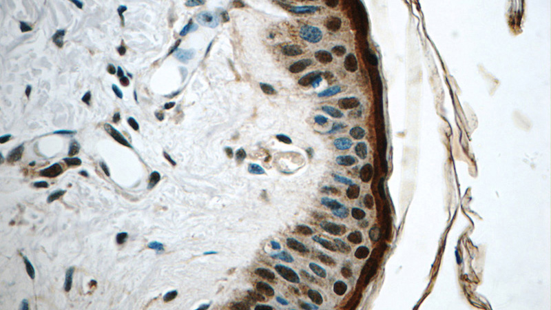 Immunohistochemistry of paraffin-embedded human skin tissue slide using Catalog No:115461(SNRPD2 Antibody) at dilution of 1:50