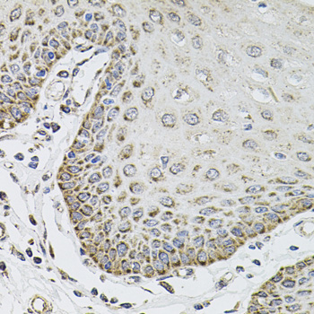 Immunohistochemistry - SDC2 Polyclonal Antibody 