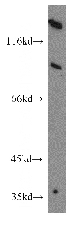 mouse liver tissue were subjected to SDS PAGE followed by western blot with Catalog No:107741(ACO1 antibody) at dilution of 1:300