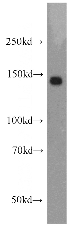 HeLa cells were subjected to SDS PAGE followed by western blot with Catalog No:114676(RECQL4 antibody) at dilution of 1:1000
