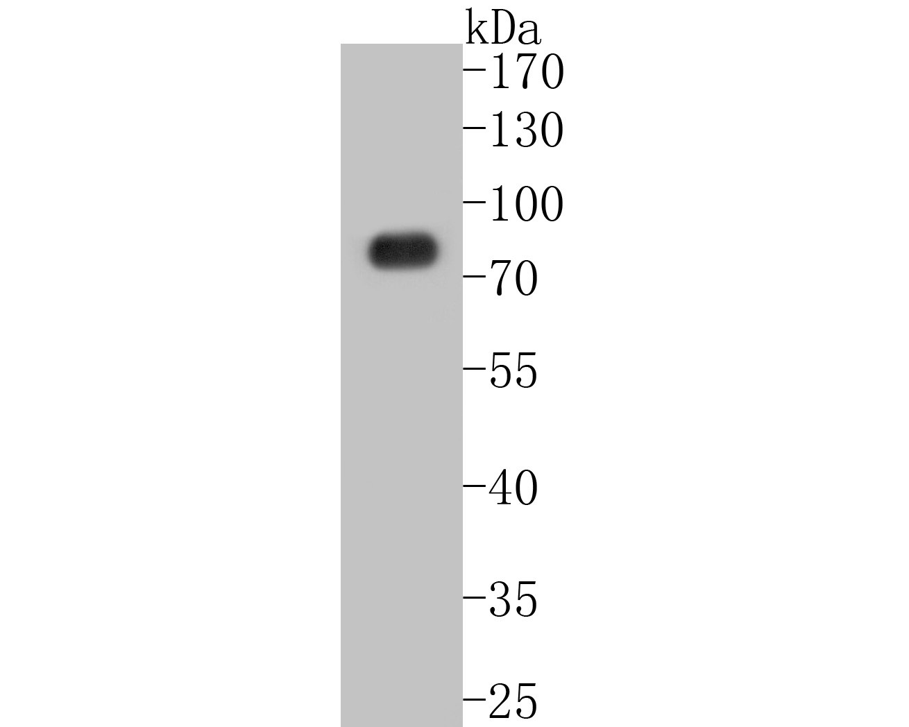 Fig1:; Western blot analysis of SLC22A3 on human placenta tissue lysates. Proteins were transferred to a PVDF membrane and blocked with 5% BSA in PBS for 1 hour at room temperature. The primary antibody ( 1/2000) was used in 5% BSA at room temperature for 2 hours. Goat Anti-Rabbit IgG - HRP Secondary Antibody (HA1001) at 1:5,000 dilution was used for 1 hour at room temperature.