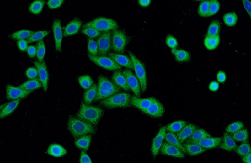 Immunofluorescent analysis of HeLa cells using Catalog No:108721(C3orf21 Antibody) at dilution of 1:50 and Alexa Fluor 488-congugated AffiniPure Goat Anti-Rabbit IgG(H+L)
