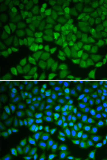 Immunofluorescence - GSS Polyclonal Antibody 