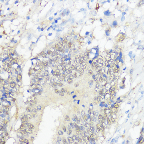 Immunohistochemistry - GPX2 Polyclonal Antibody 