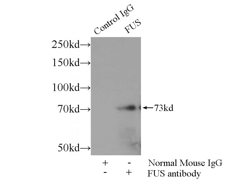 IP Result of anti-FUS/TLS (IP:Catalog No:107282, 4ug; Detection:Catalog No:107282 1:10000) with HeLa cells lysate 920ug.